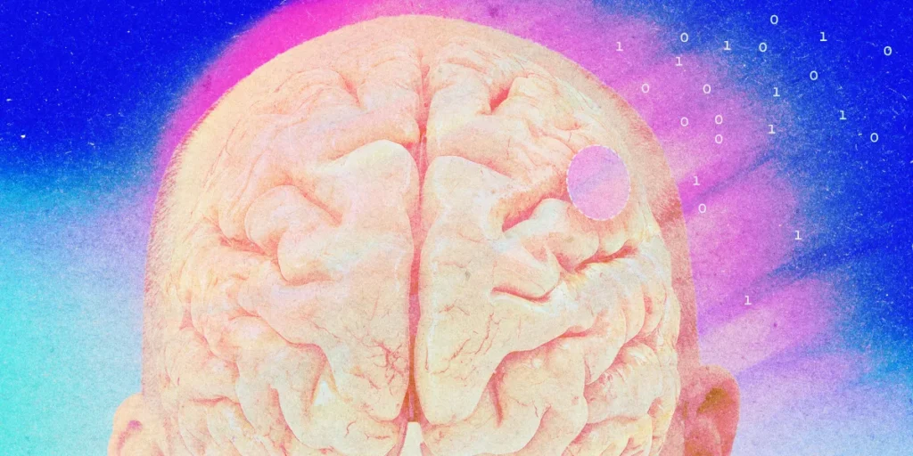 Brain-Computer Interface Trials Are Actually Taking Off Now