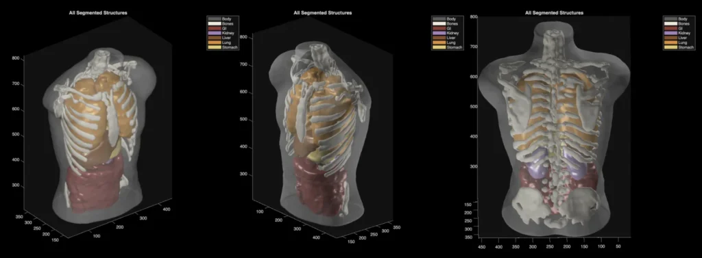 Midjourney’s New Scanner Lets You See Inside Your Body Like an MRI, But With Ultrasound