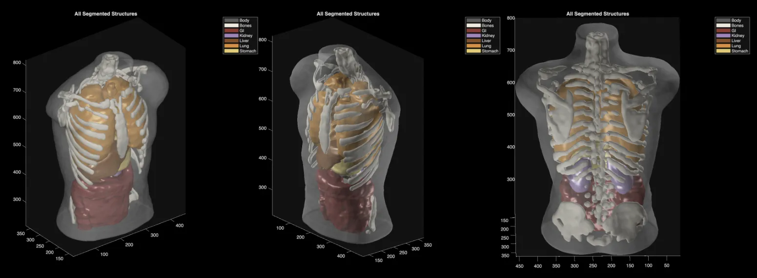 Midjourney Medical 3D scans of a “phantom” body